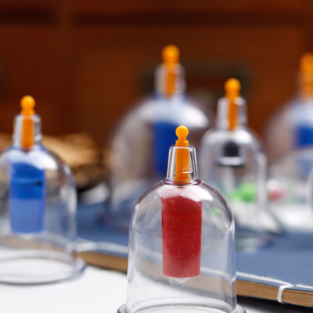 Close-up of medical-grade equipment used for cupping therapy treatment/hijama and suction therapy.